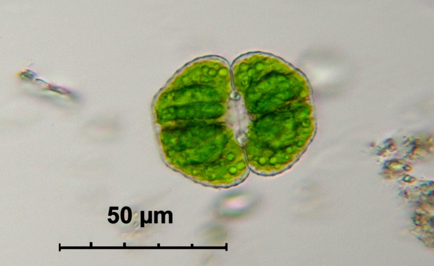 Cosmarium botrytis ? vari passaggi